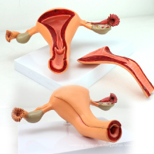 ANATOMY04 (12442) Uterine Structure Anatomical Model , Anatomy Models > Reproductive system
